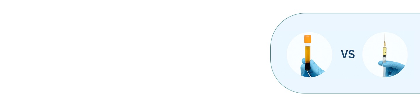 PRP vs GFC Treatment: Which is Better for Hair Regrowth?